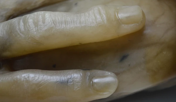 The Hand of Fannie Storr