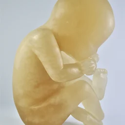 Foetus 3