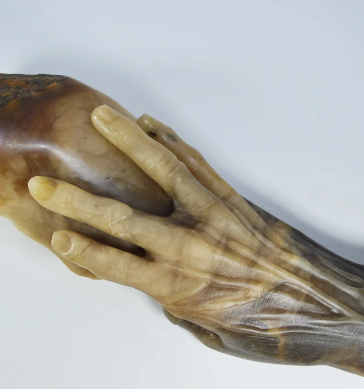 The Hand Of Fannie Storr 1