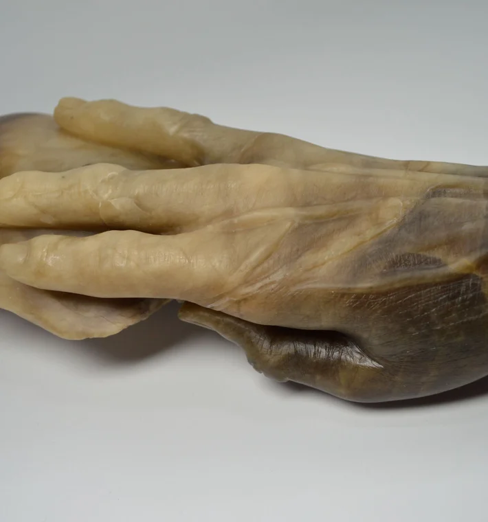 The Hand Of Fannie Storr 3