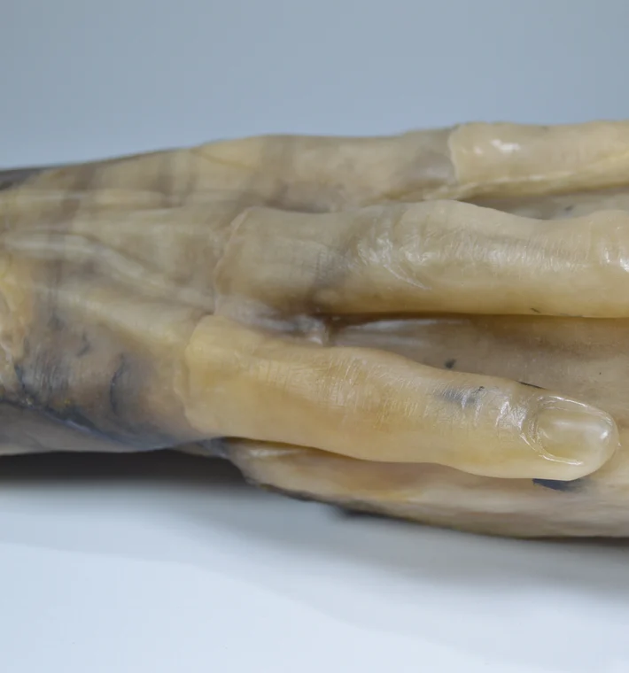 The Hand Of Fannie Storr 4