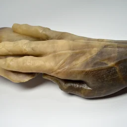 The Hand of Fannie Storr